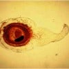 Finding God in the Cysticercoid