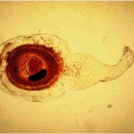 Finding God in the Cysticercoid Finding God in the Cysticercoid