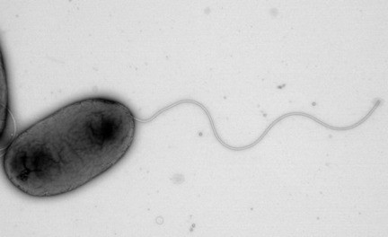 The bacterium, Pseudomonas aeruginosa, normally moves about with one tail.